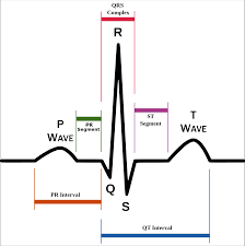 ECG