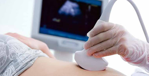 Sonography