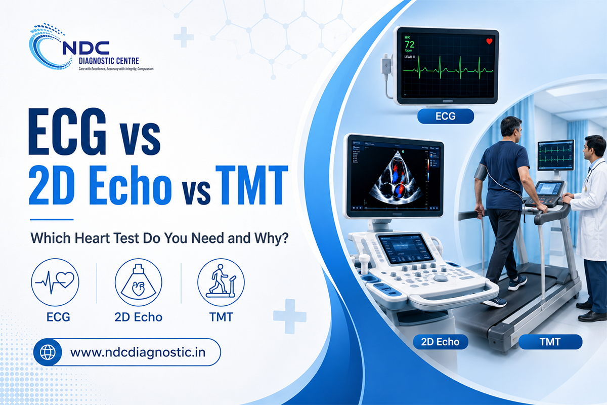 ECG vs 2D Echo vs TMT: Which Heart Test Do You Need and Why?