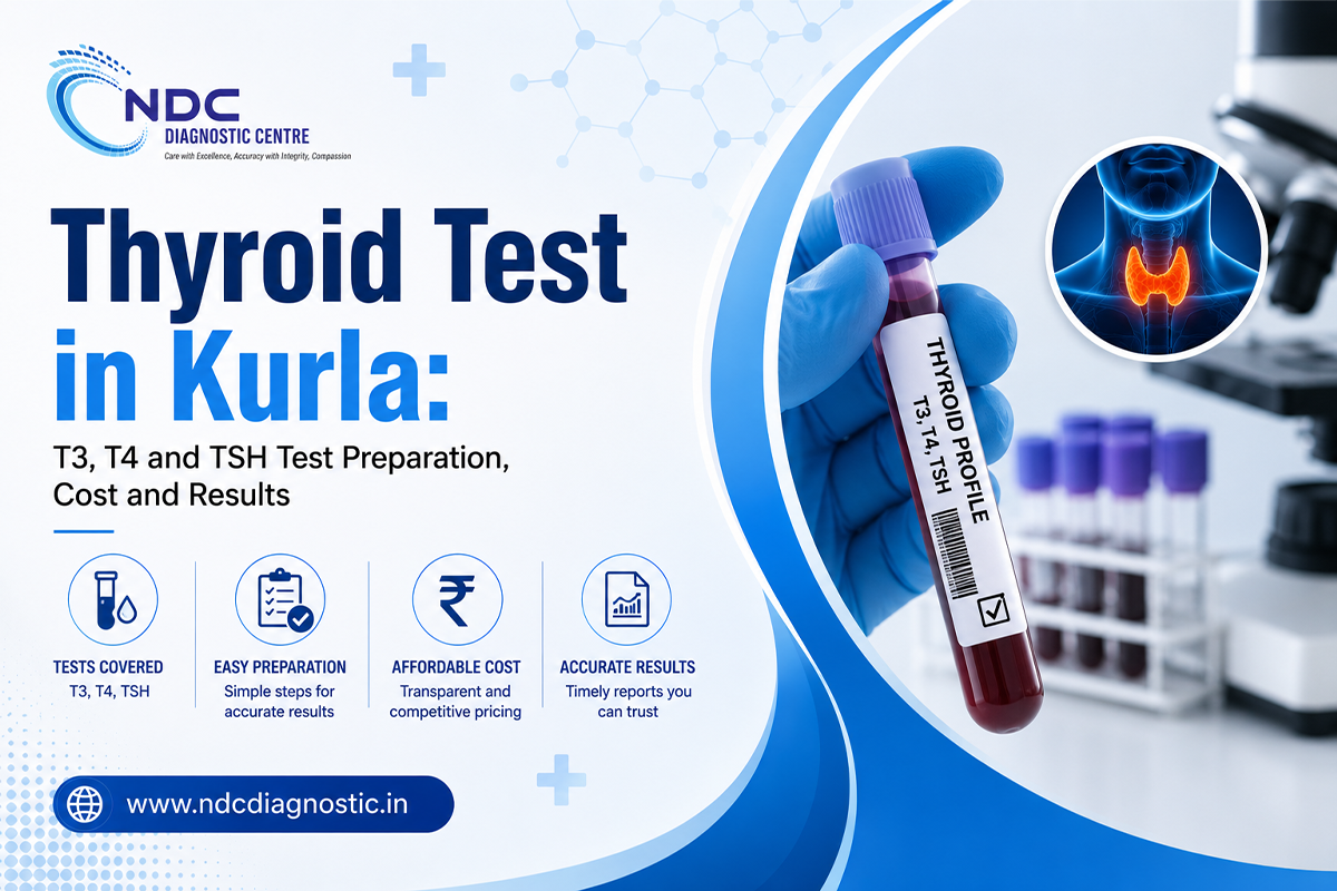 Thyroid Test in Kurla: T3, T4 and TSH Test Preparation, Cost and Results