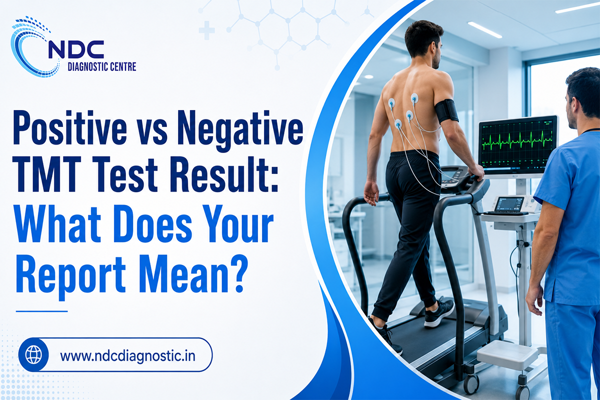 Positive vs Negative TMT Test Result: What Does Your Report Mean?