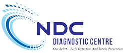 NDC Diagnostic