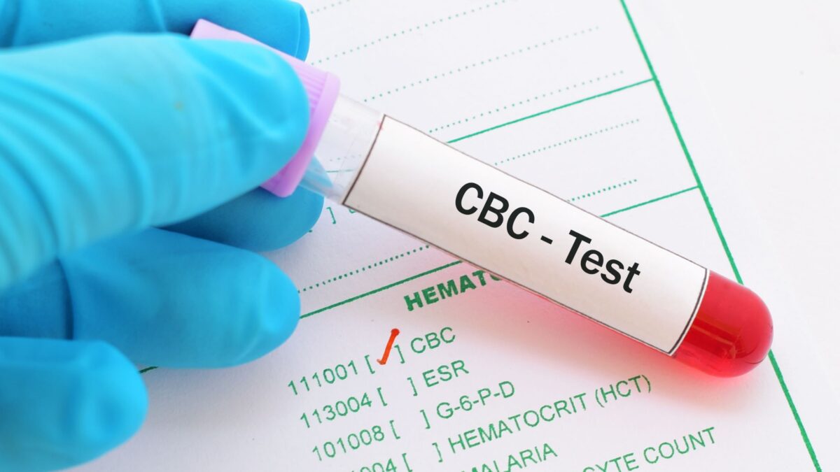 Complete Blood Count